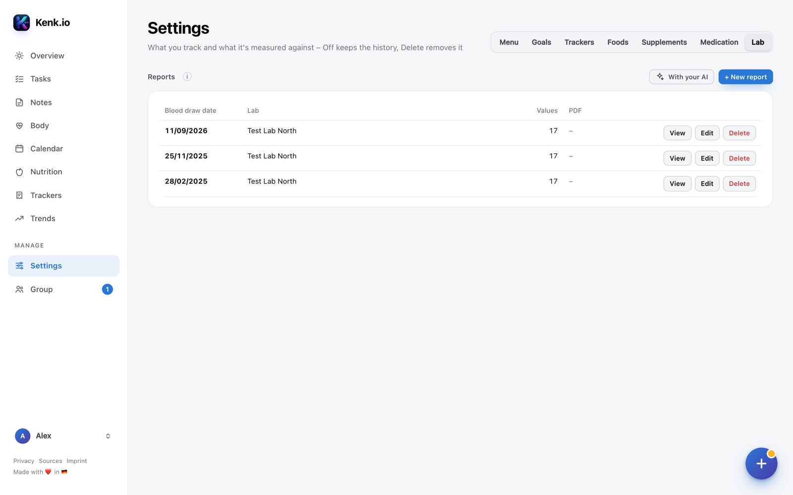 Kenk.io in the browser: Settings → Lab with three reports
